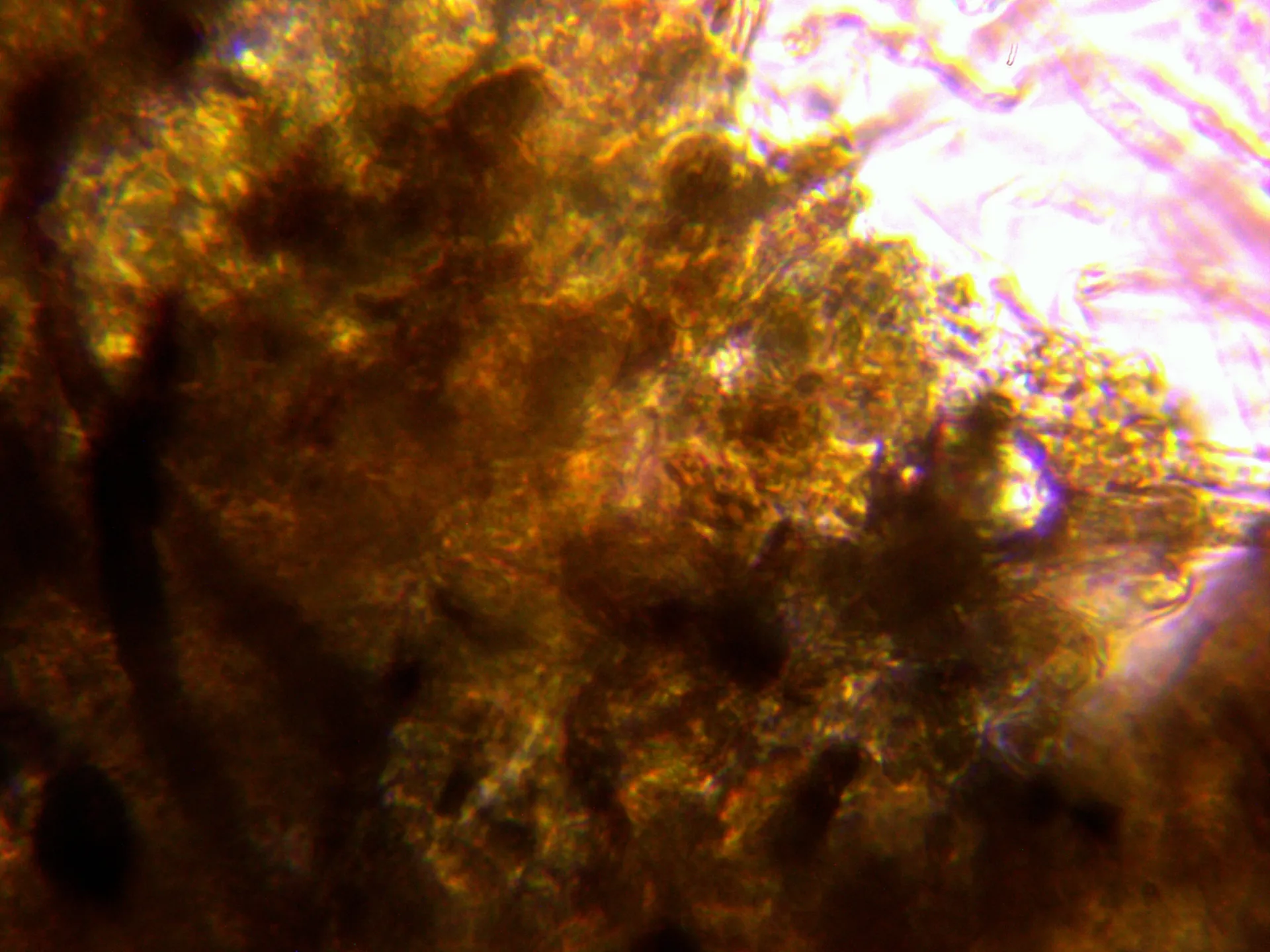 Microscopía de Tricholoma portentosum - 15 - Suprapellis